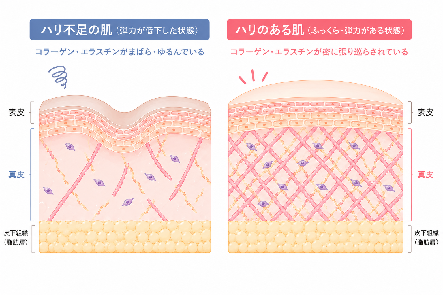ハリ不足の肌とハリのある肌の比較